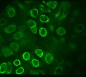 Heparan sulfate around cells in osteoarthritic cartilage