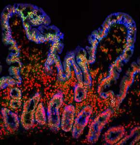 Gut wall under microscope
