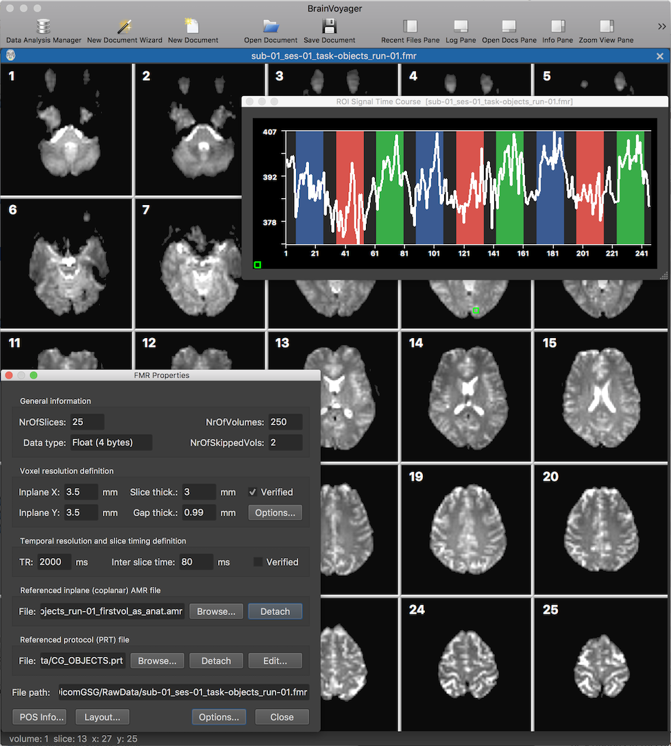 Visual representation of the brainvoyager fMRI analysis tool