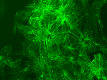 Stem cell-derived cardiomyocytes gene-edited with a fluorescent reporter for alpha actinin