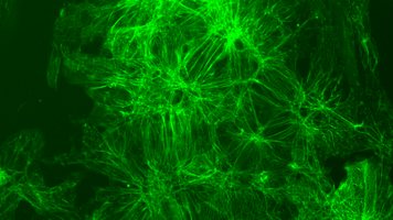 Stem cell-derived cardiomyocytes gene-edited with a fluorescent reporter for alpha actinin