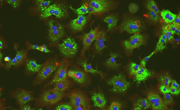 Microscopic image of lipid uptake in primary hepatocytes