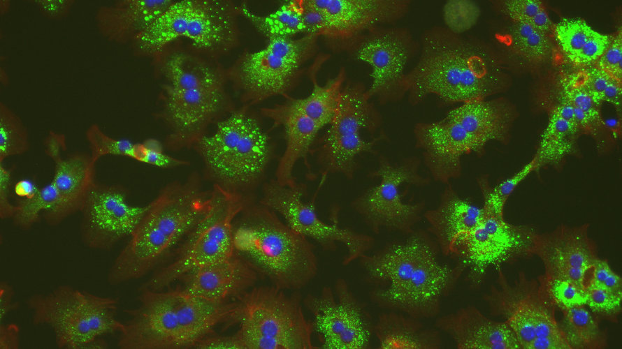 Microscopic image of lipid uptake in primary hepatocytes